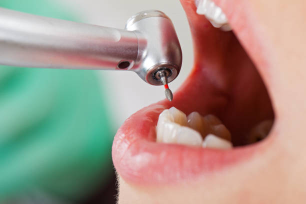 Best Emergency Treatment for Dental Infections or Abscesses in Pingree Grove, IL
